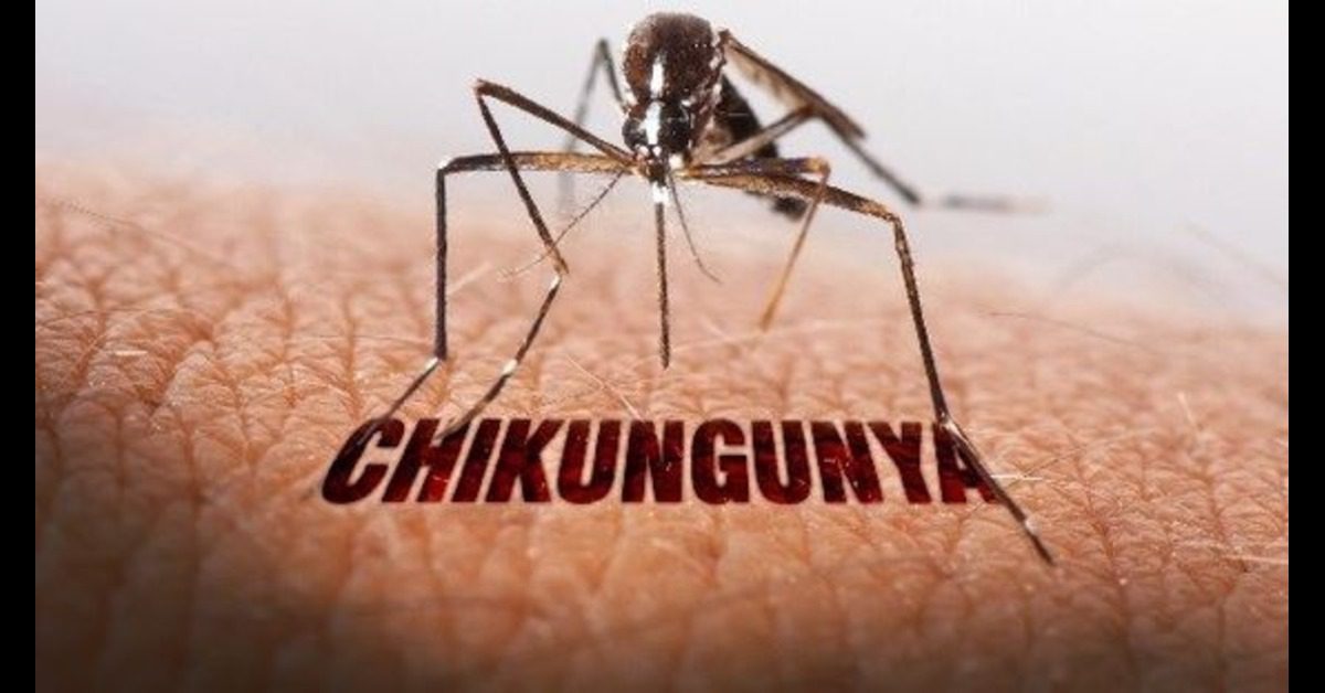 Chikungunya